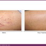B&A VBeam and journal.pptx (1)