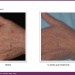 B&A VBeam and journal.pptx