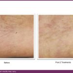 B&A VBeam and journal.pptx (2)