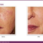 B&A VBeam and journal.pptx (3)