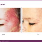 B&A VBeam and journal.pptx (4)