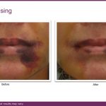 B&A VBeam and journal.pptx (5)