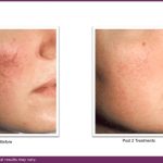 B&A VBeam and journal.pptx (6)